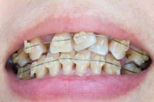 orthodontists